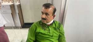 NC leader Yadav’s health condition stable